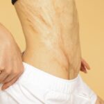 Lourdes-woman-healed