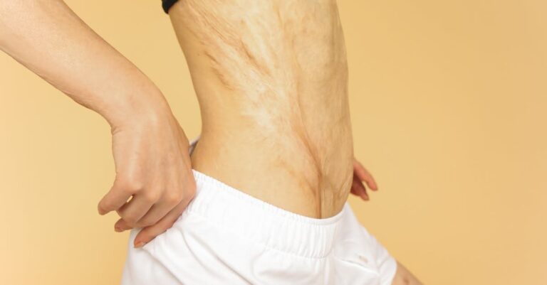 Illustration de Lourdes: 72e miracle, guérison d'Antonia Lofiégo confirmée Lourdes-woman-healed