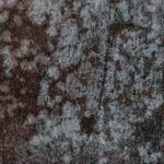 bacteria-kidney-stone