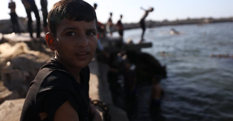 Illustration de Gaza: l'Espagne évacue des enfants, malnutrition contestée gaza-injured-children