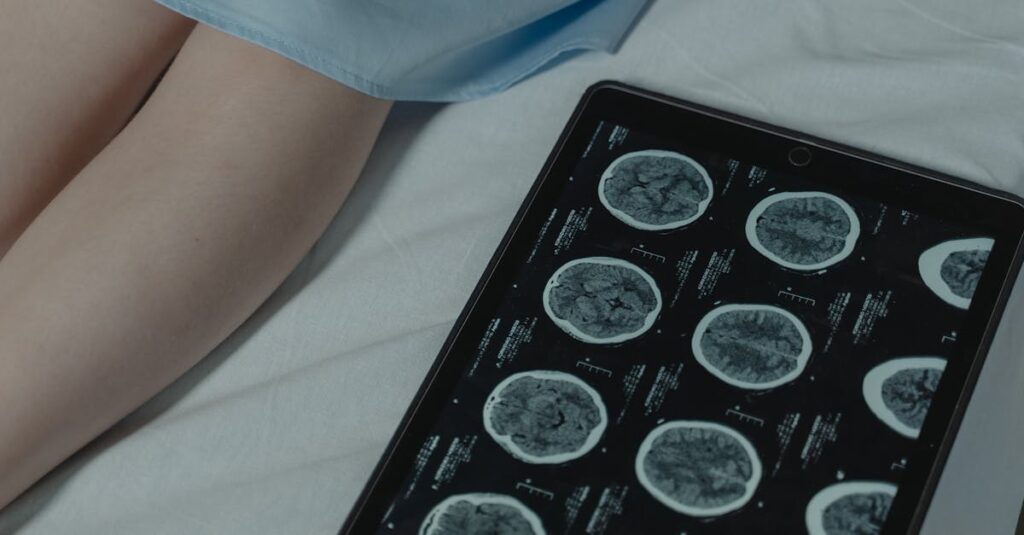 Illustration de Traumatisme crânien : un risque accru de tumeur cérébrale ? brain-injury-cancer-risk