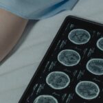 brain-injury-cancer-risk