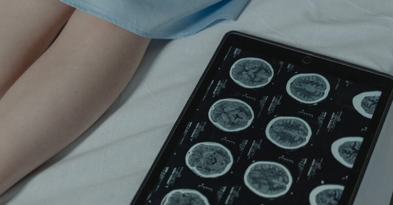 Illustration de Traumatisme crânien : un risque accru de tumeur cérébrale ? brain-injury-cancer-risk