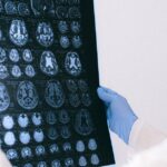 Alzheimer-treatment-research