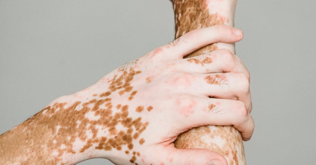 Illustration de USA : Trump durcit l'accès aux visas pour raisons de santé us-visa-rejection-medical-condition