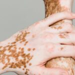 us-visa-rejection-medical-condition