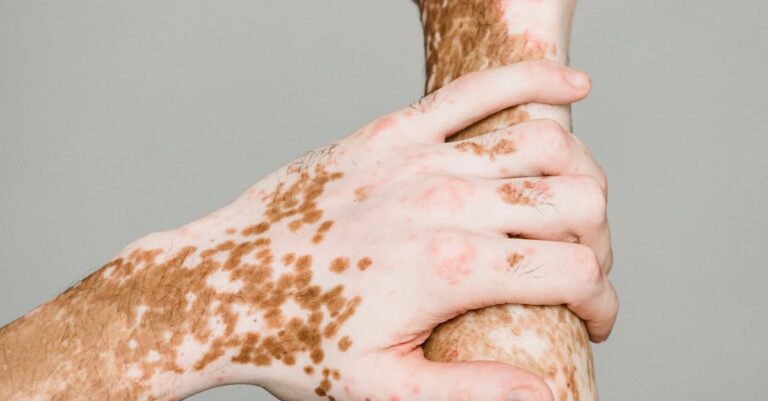 us-visa-rejection-medical-condition