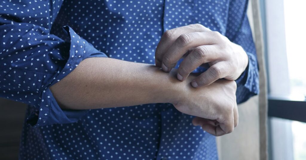 Illustration de Eczéma, psoriasis : une avancée sur les liens peau-stress stressed-skin-irritation