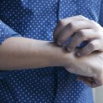 stressed-skin-irritation