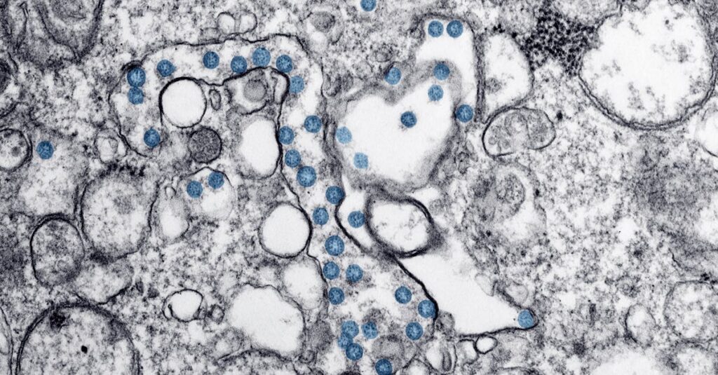 Illustration de Hantavirus en France : une souche méconnue infecte des dizaines hantavirus-microscope
