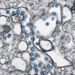 hantavirus-microscope