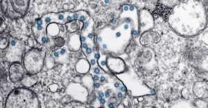 hantavirus-microscope