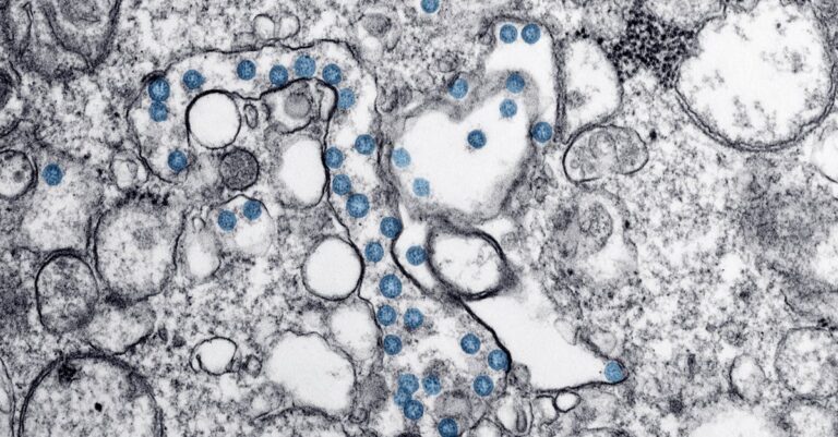 hantavirus-microscope