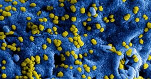 Illustration de Hépatite B : Le Bepirovirsen offre un espoir de guérison fonctionnelle hepatitis-B-virus-research